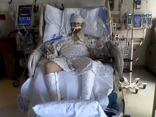 Day of Diagnosis